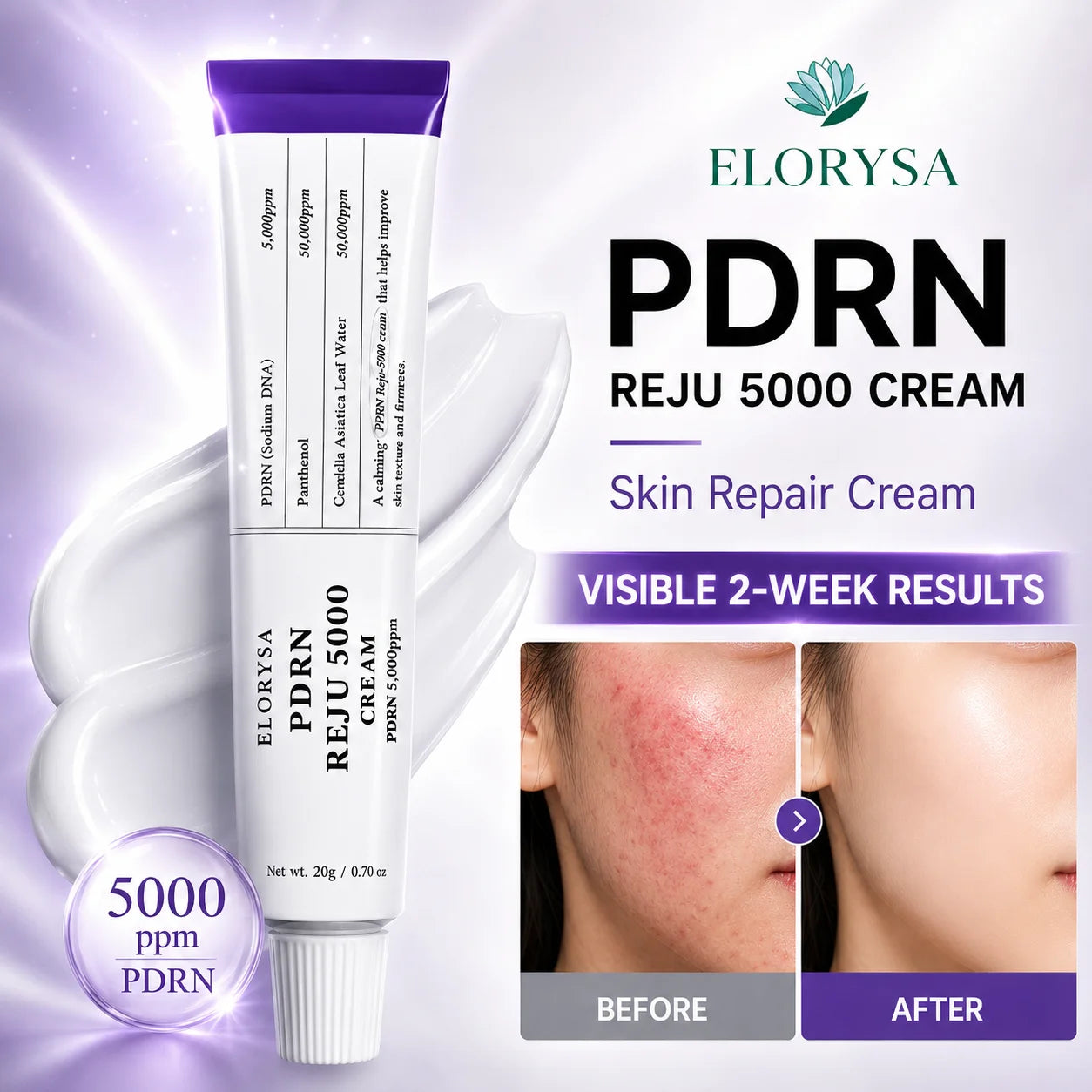 Elorysa PDRN REJU 5000 Cream: The Ultimate Skin Rejuvenation & Barrier Repair