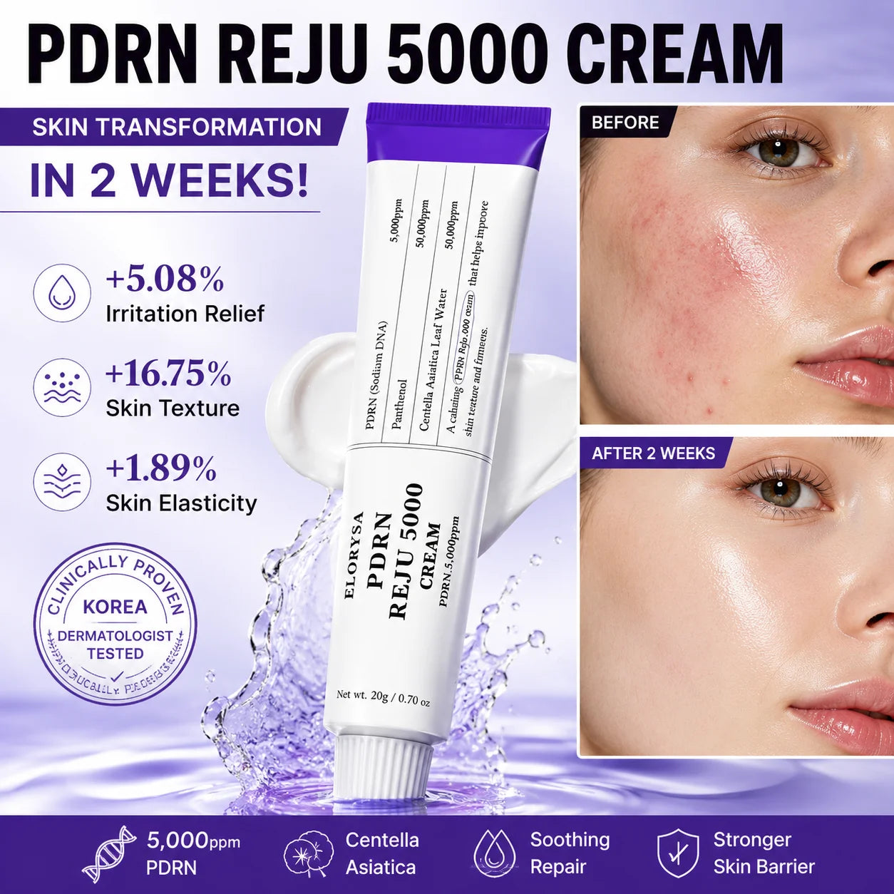 Elorysa PDRN REJU 5000 Cream: The Ultimate Skin Rejuvenation & Barrier Repair