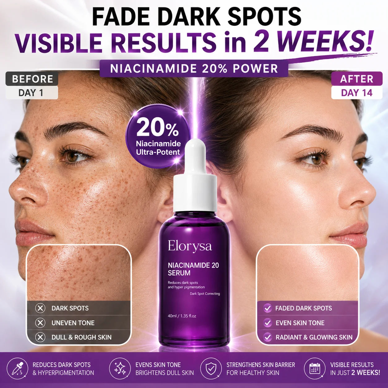 Elorysa 20% Niacinamide Dark Spot Correcting Serum for Face,Fade Dark Spots. Reveal Your Glow