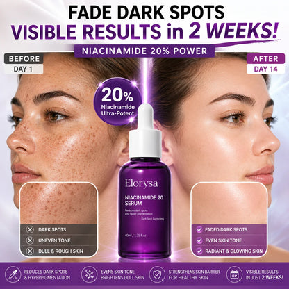 Elorysa 20% Niacinamide Dark Spot Correcting Serum for Face,Fade Dark Spots. Reveal Your Glow