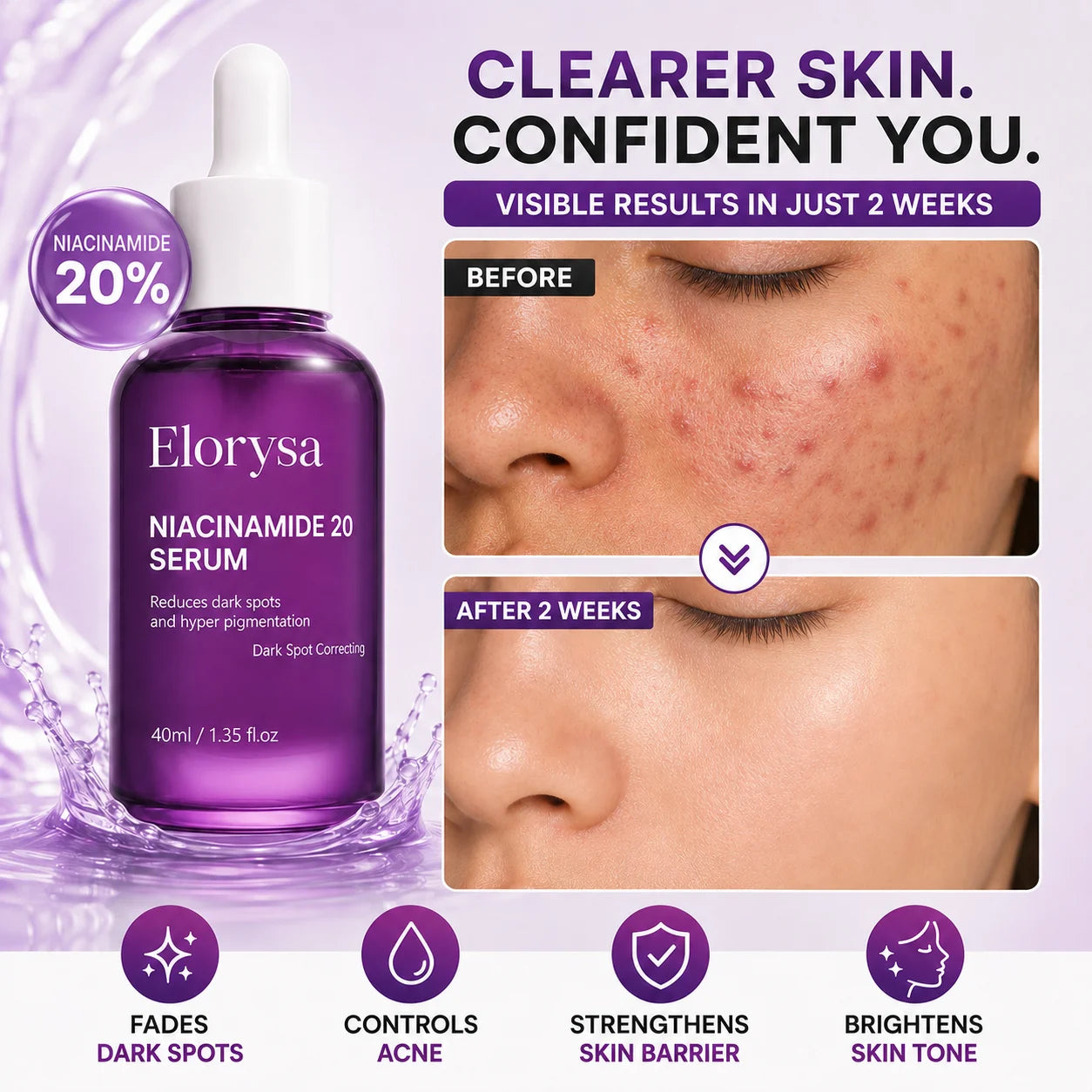 Elorysa 20% Niacinamide Dark Spot Correcting Serum for Face,Fade Dark Spots. Reveal Your Glow
