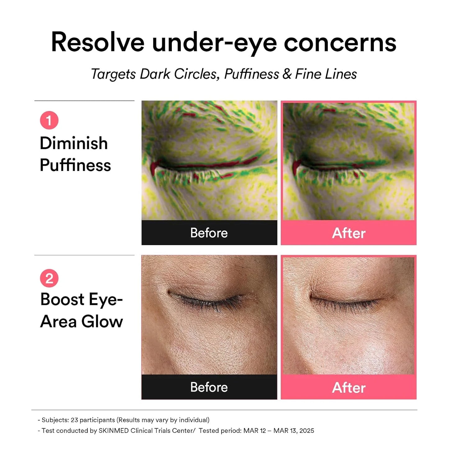Elorysa PDRN Retinal Eye Patches for Rejuvenating & Puffy Eyes with Glow Jelly, Niacinamide, 60 Count, Korean Skin Care
