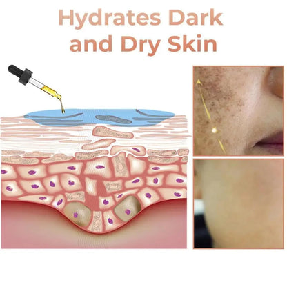 Elorysa Vitamin C + 5% Niacinamide Brightening Serum — Fade the Look of Dark Spots & Reveal Even, Glowing Skin