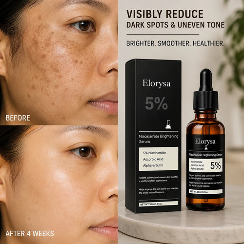Elorysa Vitamin C + 5% Niacinamide Brightening Serum — Fade the Look of Dark Spots & Reveal Even, Glowing Skin