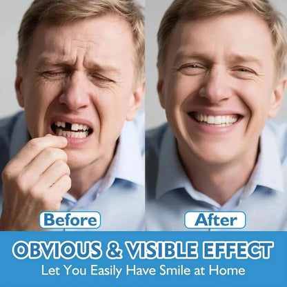 Elorysa Moldable Silicone Dentures Upper Lower False Teeth Set Instant Smile Toothbrush