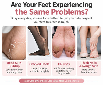 Elorysa™ Electric Foot File 👣 Smooth Rough, Dry Heels in Minutes
