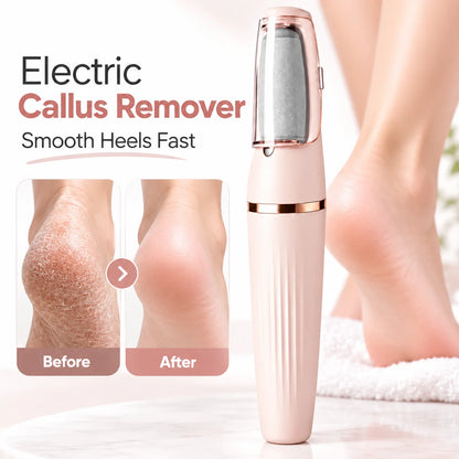 Elorysa™ Electric Foot File 👣 Smooth Rough, Dry Heels in Minutes