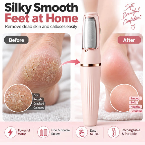 Elorysa™ Electric Foot File 👣 Smooth Rough, Dry Heels in Minutes